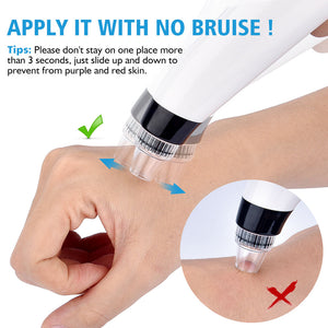 Blackhead Remover Vacuum